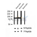 AF2419 at 1/100 staining Human thyroid cancer tissue by IHC-P. The sample was formaldehyde fixed and a heat mediated antigen retrieval step in citrate buffer was performed. The sample was then blocked and incubated with the antibody for 1.5 hours at 22¡ãC. An HRP conjugated goat anti-rabbit antibody was used as the secondary
