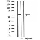 AF2737 at 1/100 staining Rat lung tissue by IHC-P. The sample was formaldehyde fixed and a heat mediated antigen retrieval step in citrate buffer was performed. The sample was then blocked and incubated with the antibody for 1.5 hours at 22¡ãC. An HRP conjugated goat anti-rabbit antibody was used as the secondary