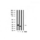 Western blot analysis of RASH/RASK/RASN expression in various lysates
