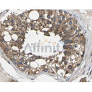 RASH/RASK/RASN Antibody