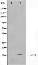 Western blot analysis on COS7 cell lysate using TGF alpha Antibody,The lane on the left is treated with the antigen-specific peptide.