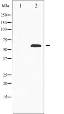 AF6331 at 1/100 staining Human prostate tissue by IHC-P. The sample was formaldehyde fixed and a heat mediated antigen retrieval step in citrate buffer was performed. The sample was then blocked and incubated with the antibody for 1.5 hours at 22¡ãC. An HRP conjugated goat anti-rabbit antibody was used as the secondary