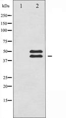 AF6338 staining HeLa by IF/ICC. The sample were fixed with PFA and permeabilized in 0.1% Triton X-100,then blocked in 10% serum for 45 minutes at 25¡ãC. The primary antibody was diluted at 1/200 and incubated with the sample for 1 hour at 37¡ãC. An Alexa Fluor 594 conjugated goat anti-rabbit IgG (H+L) Ab, diluted at 1/600, was used as the secondary antibod