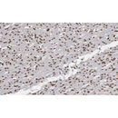 AF0291 at 1/100 staining human Smooth muscle tissue sections by IHC-P. The tissue was formaldehyde fixed and a heat mediated antigen retrieval step in citrate buffer was performed. The tissue was then blocked and incubated with the antibody for 1.5 hours at 22¡ãC. An HRP conjugated goat anti-rabbit antibody was used as the secondary