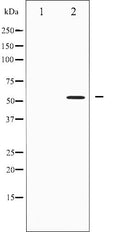 AF6438 at 1/100 staining Human lung tissue by IHC-P. The sample was formaldehyde fixed and a heat mediated antigen retrieval step in citrate buffer was performed. The sample was then blocked and incubated with the antibody for 1.5 hours at 22¡ãC. An HRP conjugated goat anti-rabbit antibody was used as the secondary