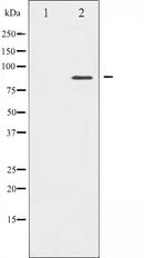 AF6441 at 1/100 staining Human breast cancer tissue by IHC-P. The sample was formaldehyde fixed and a heat mediated antigen retrieval step in citrate buffer was performed. The sample was then blocked and incubated with the antibody for 1.5 hours at 22¡ãC. An HRP conjugated goat anti-rabbit antibody was used as the secondary