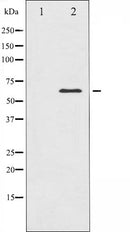 AF6460 at 1/100 staining Mouse testis tissue by IHC-P. The sample was formaldehyde fixed and a heat mediated antigen retrieval step in citrate buffer was performed. The sample was then blocked and incubated with the antibody for 1.5 hours at 22¡ãC. An HRP conjugated goat anti-rabbit antibody was used as the secondary