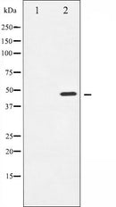 AF6495 at 1/100 staining Mouse pancreas tissue by IHC-P. The sample was formaldehyde fixed and a heat mediated antigen retrieval step in citrate buffer was performed. The sample was then blocked and incubated with the antibody for 1.5 hours at 22¡ãC. An HRP conjugated goat anti-rabbit antibody was used as the secondary