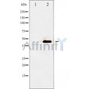 Western blot analysis of extracts from human Umbilical cord mesenchymal stem cell using Nano g Antibody
