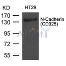 AF4039 staining COLO205 cells by IF/ICC. The sample were fixed with PFA and permeabilized in 0.1% Triton X-100,then blocked in 10% serum for 45 minutes at 25¡ãC. The primary antibody was diluted at 1/200 and incubated with the sample for 1 hour at 37¡ãC. An  Alexa Fluor 594 conjugated goat anti-rabbit IgG (H+L) antibody(Cat.