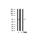 Western blot analysis of DR4 expression in rat spleen lysate