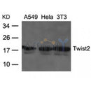AF4112 at 1/100 staining human liver tissue sections by IHC-P. The tissue was formaldehyde fixed and a heat mediated antigen retrieval step in citrate buffer was performed. The tissue was then blocked and incubated with the antibody for 1.5 hours at 22¡ãC. An HRP conjugated goat anti-rabbit antibody was used as the secondary