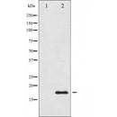 AF1019 staining HepG2 by IF/ICC. The sample were fixed with PFA and permeabilized in 0.1% Triton X-100,then blocked in 10% serum for 45 minutes at 25¡ãC. The primary antibody was diluted at 1/200 and incubated with the sample for 1 hour at 37¡ãC. An Alexa Fluor 594 conjugated goat anti-rabbit IgG (H+L) Ab, diluted at 1/600, was used as the secondary antibod
