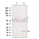 Western blot analysis of extracts from HepG2, using TP53I11 Antibody. Lane 1 was treated with the blocking peptide.