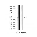 Western blot analysis of extracts from rat brain, using BCKD Antibody.
