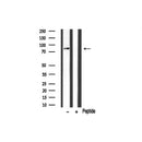 Western blot analysis of HGS expression in Rat brain lysate