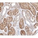 AF0321 at 1/100 staining human kidney tissue sections by IHC-P. The tissue was formaldehyde fixed and a heat mediated antigen retrieval step in citrate buffer was performed. The tissue was then blocked and incubated with the antibody for 1.5 hours at 22¡ãC. An HRP conjugated goat anti-rabbit antibody was used as the secondary
