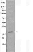 DF3162 staining COLO205 cells by IF/ICC. The sample were fixed with PFA and permeabilized in 0.1% Triton X-100,then blocked in 10% serum for 45 minutes at 25¡ãC. The primary antibody was diluted at 1/200 and incubated with the sample for 1 hour at 37¡ãC. An Alexa Fluor 594 conjugated goat anti-rabbit IgG (H+L) antibody(Cat.
