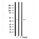 DF3259 staining Hela cells by IF/ICC. The sample were fixed with PFA and permeabilized in 0.1% Triton X-100,then blocked in 10% serum for 45 minutes at 25¡ãC. The primary antibody was diluted at 1/200 and incubated with the sample for 1 hour at 37¡ãC. An Alexa Fluor 594 conjugated goat anti-rabbit IgG (H+L) antibody(Cat.