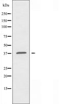 DF3262 staining COLO205 by IF/ICC. The sample were fixed with PFA and permeabilized in 0.1% Triton X-100,then blocked in 10% serum for 45 minutes at 25¡ãC. The primary antibody was diluted at 1/200 and incubated with the sample for 1 hour at 37¡ãC. An Alexa Fluor 594 conjugated goat anti-rabbit IgG (H+L) Ab, diluted at 1/600, was used as the secondary antibod