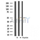 Western blot analysis of extracts from 293, using ADCK3 Antibody.