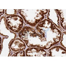 DF3229 staining LOVO by IF/ICC. The sample were fixed with PFA and permeabilized in 0.1% Triton X-100,then blocked in 10% serum for 45 minutes at 25¡ãC. The primary antibody was diluted at 1/200 and incubated with the sample for 1 hour at 37¡ãC. An Alexa Fluor 594 conjugated goat anti-rabbit IgG (H+L) Ab, diluted at 1/600, was used as the secondary antibod