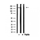 DF3294 at 1/100 staining Mouse colon tissue by IHC-P. The sample was formaldehyde fixed and a heat mediated antigen retrieval step in citrate buffer was performed. The sample was then blocked and incubated with the antibody for 1.5 hours at 22¡ãC. An HRP conjugated goat anti-rabbit antibody was used as the secondary