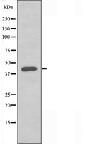 DF3302 at 1/100 staining Mouse muscle tissue by IHC-P. The sample was formaldehyde fixed and a heat mediated antigen retrieval step in citrate buffer was performed. The sample was then blocked and incubated with the antibody for 1.5 hours at 22¡ãC. An HRP conjugated goat anti-rabbit antibody was used as the secondary