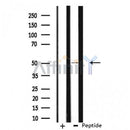 DF3303 staining 293 cells by IF/ICC. The sample were fixed with PFA and permeabilized in 0.1% Triton X-100,then blocked in 10% serum for 45 minutes at 25¡ãC. The primary antibody was diluted at 1/200 and incubated with the sample for 1 hour at 37¡ãC. An Alexa Fluor 594 conjugated goat anti-rabbit IgG (H+L) antibody(Cat.