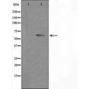 DF3308 staining HepG2 by IF/ICC. The sample were fixed with PFA and permeabilized in 0.1% Triton X-100,then blocked in 10% serum for 45 minutes at 25¡ãC. The primary antibody was diluted at 1/200 and incubated with the sample for 1 hour at 37¡ãC. An Alexa Fluor 594 conjugated goat anti-rabbit IgG (H+L) Ab, diluted at 1/600, was used as the secondary antibod