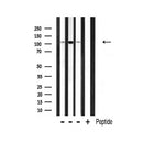 DF3319 staining Hela by IF/ICC. The sample were fixed with PFA and permeabilized in 0.1% Triton X-100,then blocked in 10% serum for 45 minutes at 25¡ãC. The primary antibody was diluted at 1/200 and incubated with the sample for 1 hour at 37¡ãC. An Alexa Fluor 594 conjugated goat anti-rabbit IgG (H+L) Ab, diluted at 1/600, was used as the secondary antibod