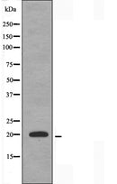 DF3326 staining HuvEc by IF/ICC. The sample were fixed with PFA and permeabilized in 0.1% Triton X-100,then blocked in 10% serum for 45 minutes at 25¡ãC. The primary antibody was diluted at 1/200 and incubated with the sample for 1 hour at 37¡ãC. An Alexa Fluor 594 conjugated goat anti-rabbit IgG (H+L) Ab, diluted at 1/600, was used as the secondary antibod