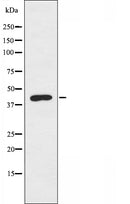DF3332 staining COLO205 cells by IF/ICC. The sample were fixed with PFA and permeabilized in 0.1% Triton X-100,then blocked in 10% serum for 45 minutes at 25¡ãC. The primary antibody was diluted at 1/200 and incubated with the sample for 1 hour at 37¡ãC. An Alexa Fluor 594 conjugated goat anti-rabbit IgG (H+L) antibody(Cat.