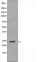 DF3333 staining 293 cells by IF/ICC. The sample were fixed with PFA and permeabilized in 0.1% Triton X-100,then blocked in 10% serum for 45 minutes at 25¡ãC. The primary antibody was diluted at 1/200 and incubated with the sample for 1 hour at 37¡ãC. An Alexa Fluor 594 conjugated goat anti-rabbit IgG (H+L) antibody(Cat.