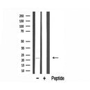 DF3345 staining LOVO by IF/ICC. The sample were fixed with PFA and permeabilized in 0.1% Triton X-100,then blocked in 10% serum for 45 minutes at 25¡ãC. The primary antibody was diluted at 1/200 and incubated with the sample for 1 hour at 37¡ãC. An Alexa Fluor 594 conjugated goat anti-rabbit IgG (H+L) Ab, diluted at 1/600, was used as the secondary antibod