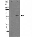DF3351 at 1/100 staining Mouse intestine tissue by IHC-P. The sample was formaldehyde fixed and a heat mediated antigen retrieval step in citrate buffer was performed. The sample was then blocked and incubated with the antibody for 1.5 hours at 22¡ãC. An HRP conjugated goat anti-rabbit antibody was used as the secondary