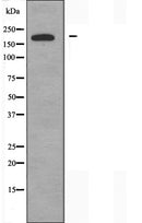 DF3518 at 1/100 staining Mouse kidney tissue by IHC-P. The sample was formaldehyde fixed and a heat mediated antigen retrieval step in citrate buffer was performed. The sample was then blocked and incubated with the antibody for 1.5 hours at 22¡ãC. An HRP conjugated goat anti-rabbit antibody was used as the secondary
