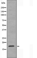 DF3522 staining Hela by IF/ICC. The sample were fixed with PFA and permeabilized in 0.1% Triton X-100,then blocked in 10% serum for 45 minutes at 25¡ãC. The primary antibody was diluted at 1/200 and incubated with the sample for 1 hour at 37¡ãC. An Alexa Fluor 594 conjugated goat anti-rabbit IgG (H+L) Ab, diluted at 1/600, was used as the secondary antibod