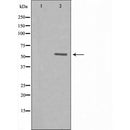 DF3365 at 1/100 staining Human breast cancer tissue by IHC-P. The sample was formaldehyde fixed and a heat mediated antigen retrieval step in citrate buffer was performed. The sample was then blocked and incubated with the antibody for 1.5 hours at 22¡ãC. An HRP conjugated goat anti-rabbit antibody was used as the secondary