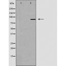 DF3378 at 1/100 staining Mouse testis tissue by IHC-P. The sample was formaldehyde fixed and a heat mediated antigen retrieval step in citrate buffer was performed. The sample was then blocked and incubated with the antibody for 1.5 hours at 22¡ãC. An HRP conjugated goat anti-rabbit antibody was used as the secondary