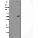 DF3384 staining HeLa cells by IF/ICC. The sample were fixed with PFA and permeabilized in 0.1% Triton X-100,then blocked in 10% serum for 45 minutes at 25¡ãC. The primary antibody was diluted at 1/200 and incubated with the sample for 1 hour at 37¡ãC. An Alexa Fluor 594 conjugated goat anti-rabbit IgG (H+L) antibody(Cat.