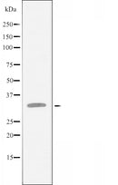 DF3387 staining COLO205 cells by IF/ICC. The sample were fixed with PFA and permeabilized in 0.1% Triton X-100,then blocked in 10% serum for 45 minutes at 25¡ãC. The primary antibody was diluted at 1/200 and incubated with the sample for 1 hour at 37¡ãC. An Alexa Fluor 594 conjugated goat anti-rabbit IgG (H+L) antibody(Cat.