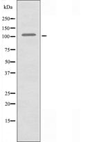 DF3397 staining HT29 cells by IF/ICC. The sample were fixed with PFA and permeabilized in 0.1% Triton X-100,then blocked in 10% serum for 45 minutes at 25¡ãC. The primary antibody was diluted at 1/200 and incubated with the sample for 1 hour at 37¡ãC. An Alexa Fluor 594 conjugated goat anti-rabbit IgG (H+L) antibody(Cat.