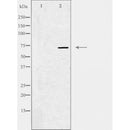 DF3410 staining HepG2 cells by IF/ICC. The sample were fixed with PFA and permeabilized in 0.1% Triton X-100,then blocked in 10% serum for 45 minutes at 25¡ãC. The primary antibody was diluted at 1/200 and incubated with the sample for 1 hour at 37¡ãC. An Alexa Fluor 594 conjugated goat anti-rabbit IgG (H+L) antibody(Cat.