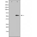 DF3415 staining HuvEc cells by IF/ICC. The sample were fixed with PFA and permeabilized in 0.1% Triton X-100,then blocked in 10% serum for 45 minutes at 25¡ãC. The primary antibody was diluted at 1/200 and incubated with the sample for 1 hour at 37¡ãC. An Alexa Fluor 594 conjugated goat anti-rabbit IgG (H+L) antibody(Cat.