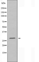 DF3494 staining HeLa cells by IF/ICC. The sample were fixed with PFA and permeabilized in 0.1% Triton X-100,then blocked in 10% serum for 45 minutes at 25¡ãC. The primary antibody was diluted at 1/200 and incubated with the sample for 1 hour at 37¡ãC. An Alexa Fluor 594 conjugated goat anti-rabbit IgG (H+L) antibody(Cat.