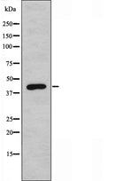DF3496 staining HepG2 by IF/ICC. The sample were fixed with PFA and permeabilized in 0.1% Triton X-100,then blocked in 10% serum for 45 minutes at 25¡ãC. The primary antibody was diluted at 1/200 and incubated with the sample for 1 hour at 37¡ãC. An Alexa Fluor 594 conjugated goat anti-rabbit IgG (H+L) Ab, diluted at 1/600, was used as the secondary antibod