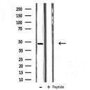 DF3497 at 1/100 staining Human liver cancer tissue by IHC-P. The sample was formaldehyde fixed and a heat mediated antigen retrieval step in citrate buffer was performed. The sample was then blocked and incubated with the antibody for 1.5 hours at 22¡ãC. An HRP conjugated goat anti-rabbit antibody was used as the secondary
