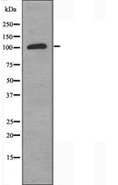 DF3507 staining Hela cells by IF/ICC. The sample were fixed with PFA and permeabilized in 0.1% Triton X-100,then blocked in 10% serum for 45 minutes at 25¡ãC. The primary antibody was diluted at 1/200 and incubated with the sample for 1 hour at 37¡ãC. An Alexa Fluor 594 conjugated goat anti-rabbit IgG (H+L) antibody(Cat.