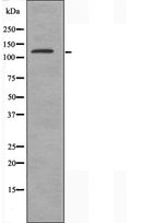 DF3508 at 1/100 staining Human liver cancer tissue by IHC-P. The sample was formaldehyde fixed and a heat mediated antigen retrieval step in citrate buffer was performed. The sample was then blocked and incubated with the antibody for 1.5 hours at 22¡ãC. An HRP conjugated goat anti-rabbit antibody was used as the secondary